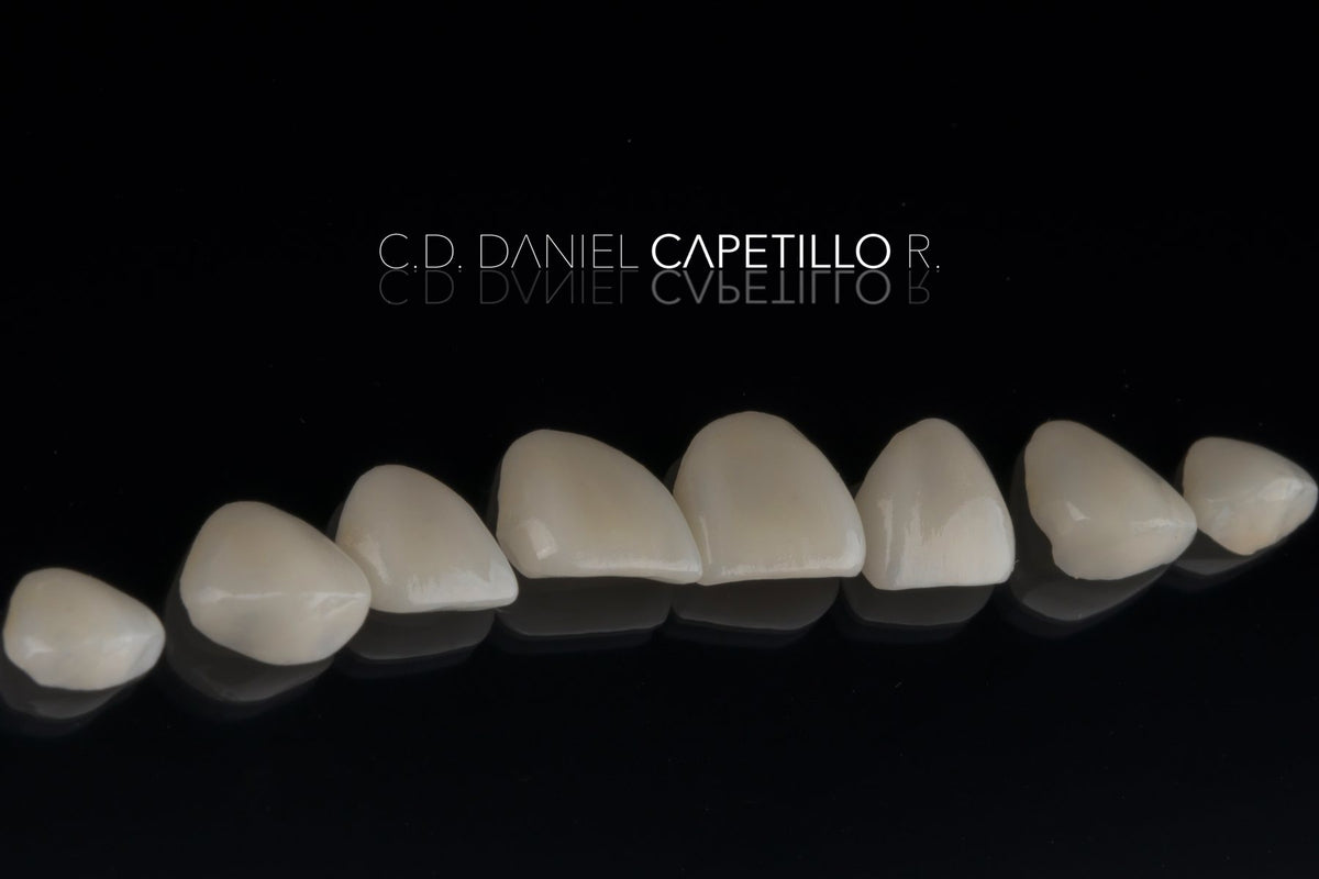 Porcelain veneers on a dark surface before placement